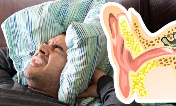 tinnitus
